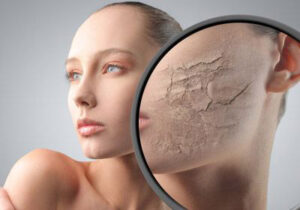 Quru və Normal Dərilər Üçün Nəmləndirici Rütin: Tonik, Serum və Krem Addımları